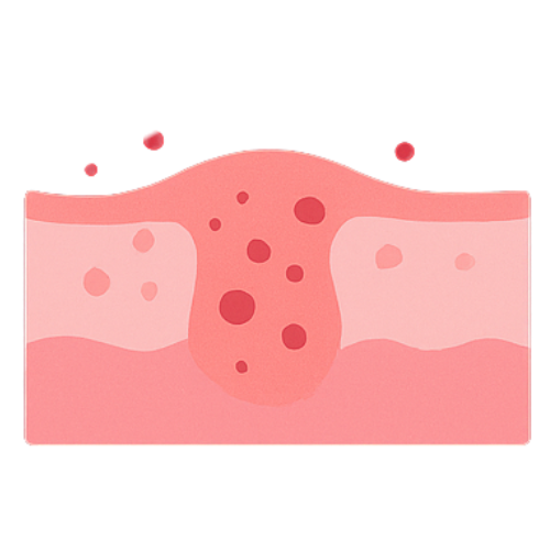 Anti-inflammatoire